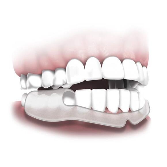 Plackers Grind No More Dental Night Guard for Teeth Grinding, 14 Count - Picture 6 of 8